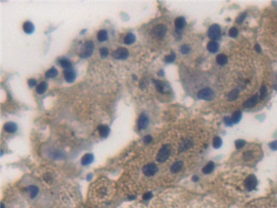 卵泡抑素(FS)多克隆抗体
