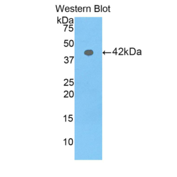 含Ⅲ型纤连蛋白域蛋白5(FNDC5)多克隆抗体