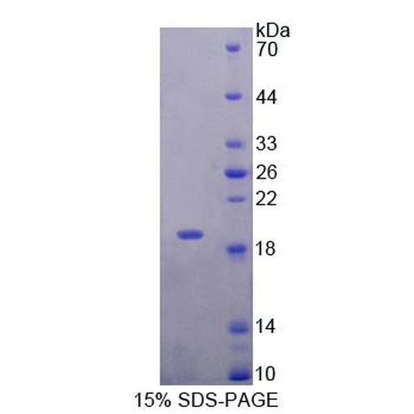 干扰素γ诱导蛋白30(IFI30)重组蛋白(多属种)