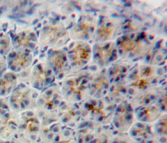 甲状腺球蛋白(TG)多克隆抗体
