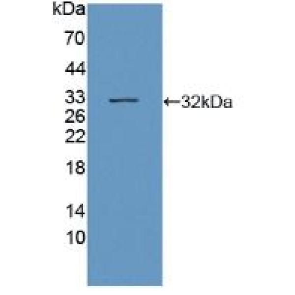 醛固酮合酶(ALDOS)多克隆抗体