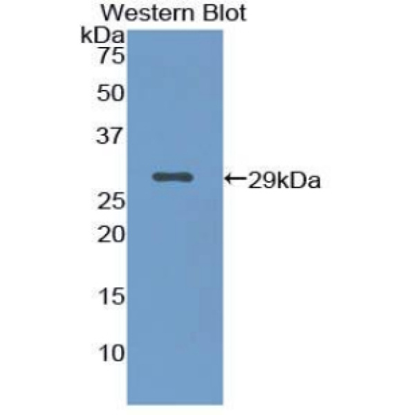 FK506结合蛋白8(FKBP8)多克隆抗体