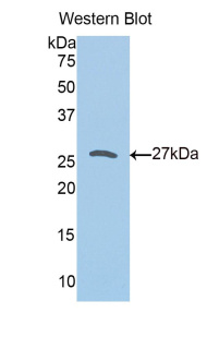 Lin-28同源物A(LIN28A)多克隆抗体