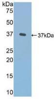 突触核蛋白&#947;(SNCG)多克隆抗体