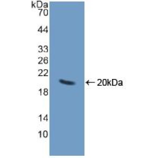 角蛋白14(KRT14)多克隆抗体