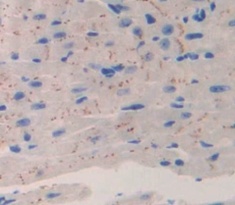 氨基端前心钠肽(NT-ProANP)多克隆抗体