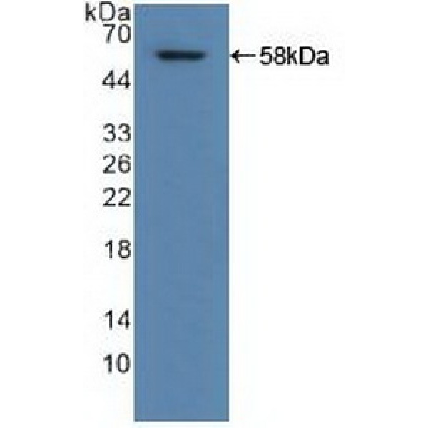 钙/钙调蛋白依赖性蛋白激酶Ⅱγ(CAMK2g)多克隆抗体