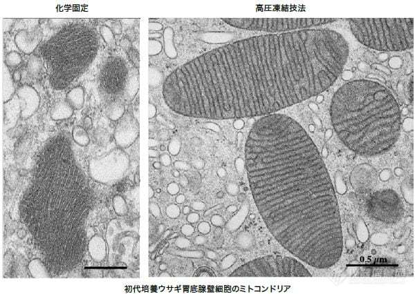 用透射电镜解读生命学难题——访宫崎大学医学部泽口朗教授