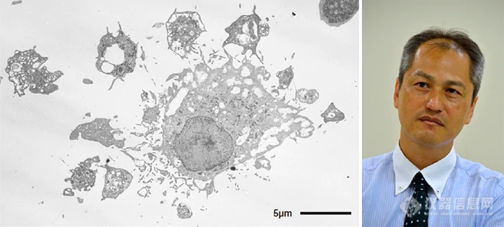 用透射电镜解读生命学难题——访宫崎大学医学部泽口朗教授