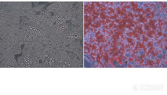 间充质干细胞在成脂后染色前（D）和染色后（E）的照片（400×）.jpg
