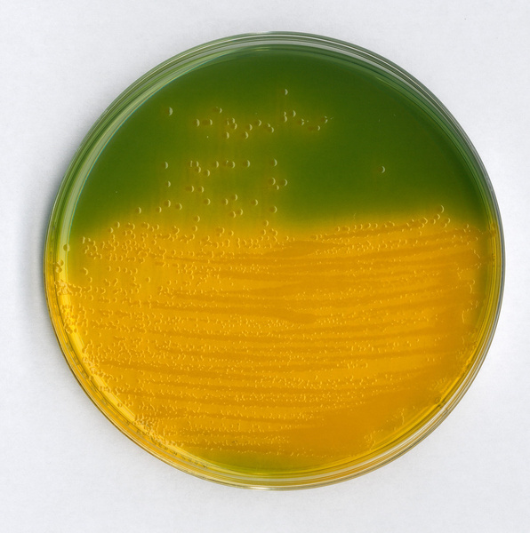 默克密理博milliporetcbs培养基1.10263.0500