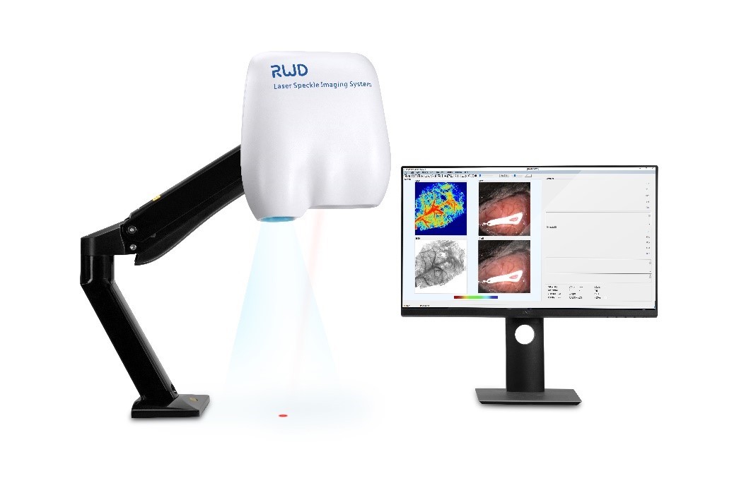RFLSI Ⅲ激光散斑血流成像系统 激光多普勒 血流仪