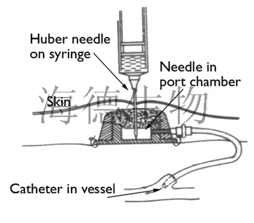 Huber注射针