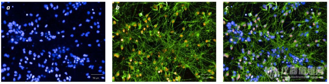 DISEASE In A DISH | 基于诱导多功能干细胞iPSC来源的药物研发