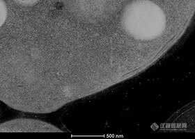 酵母细胞的STEM厚切片图像放大倍率= 35,000x.jpg