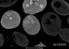 酵母细胞的低倍STEM厚截面图像.jpg