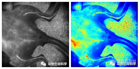 新品发布 | 激光散斑血流成像系统RFLSI Ⅲ全新来袭