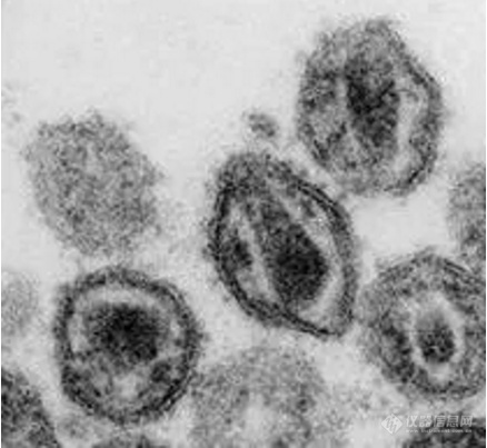 日立透射电镜HT7800 病毒颗粒全自动分析方案