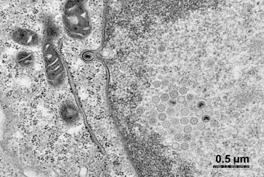 Vero细胞内的HSV病毒（被感染细胞的组织切片）.jpg