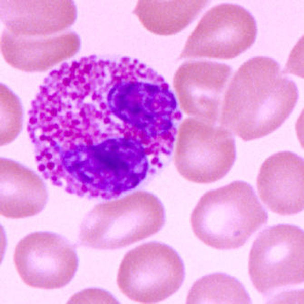 抗人转铁蛋白单抗杂交瘤细胞；Ferritin-1规格