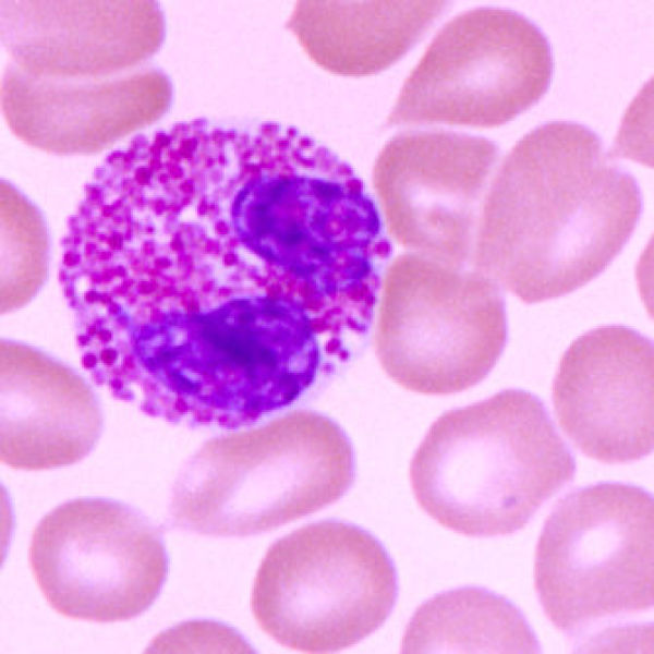人急性淋巴白血病细胞；Kasumi-1说明书