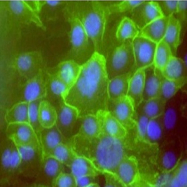 Vero-HCV-NS4B非洲绿猴肾细胞系