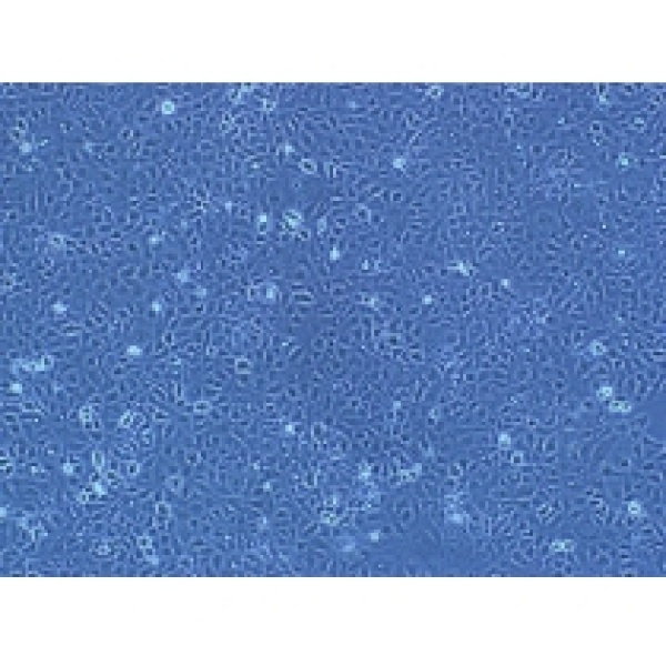293 001B人胚肾细胞(Sars结构蛋白基因修饰）