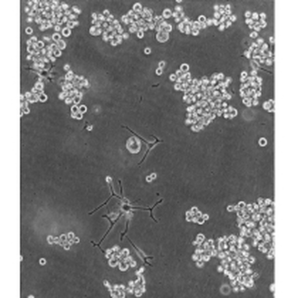 CW-2人结肠癌细胞