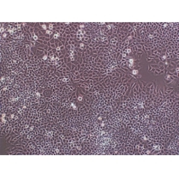  Ecad231-9人乳腺癌细胞