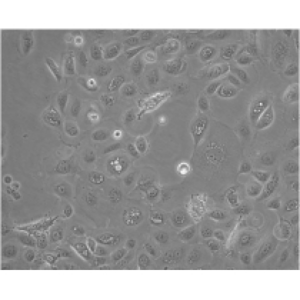 hEM15A人子宫内膜异位症患者在位内膜间质细胞永生化细胞