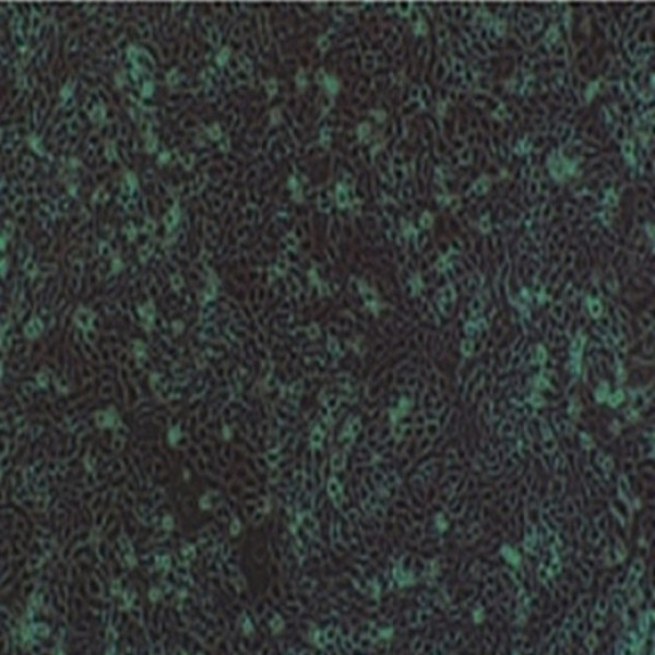 MDA-MB-231-GFP人乳腺癌细胞
