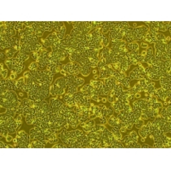 AMO-1人骨髓浆细胞瘤株