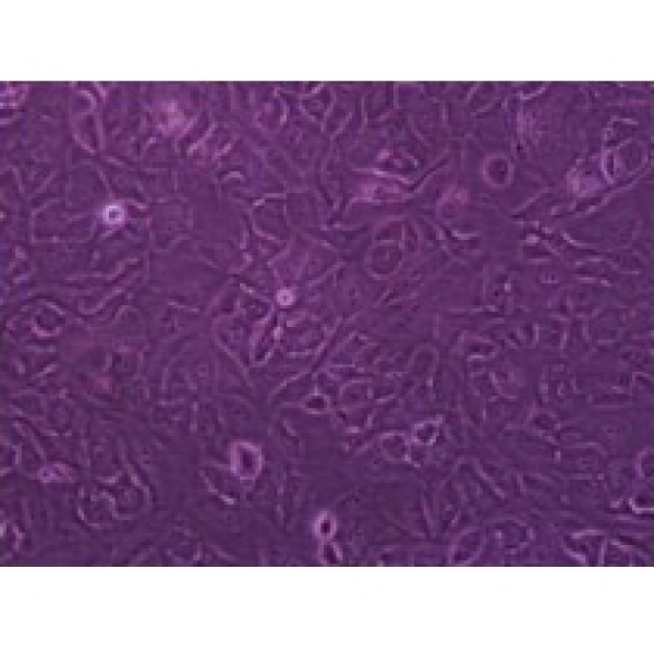  COC1/DDP人卵巢癌细胞COC0耐药亚株，对顺铂耐药