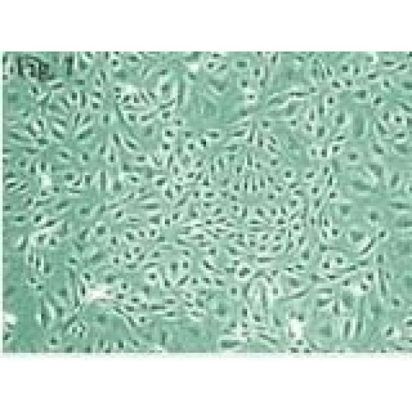   HCT116-GFP绿色荧光蛋白标记人结直肠癌细胞