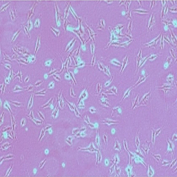 兔膀胱基质成纤维细胞