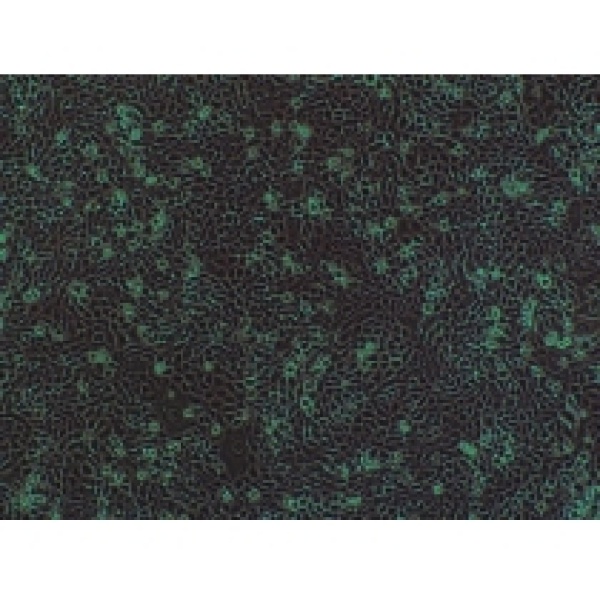CTX-TNA大鼠脑I型星形胶质细胞