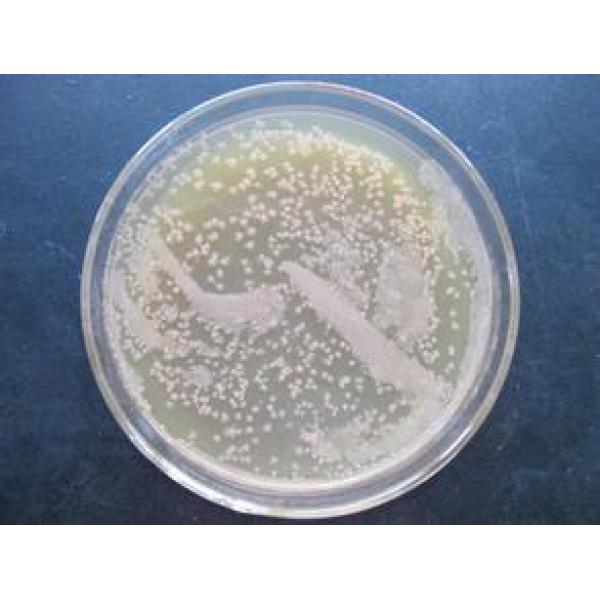 溶藻细菌