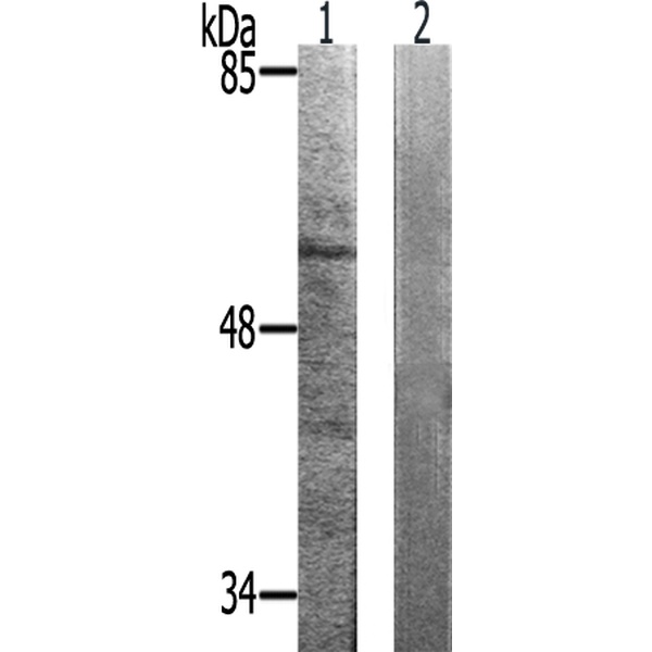 兔抗CHEK2(Phospho-Thr383) 多克隆抗体  