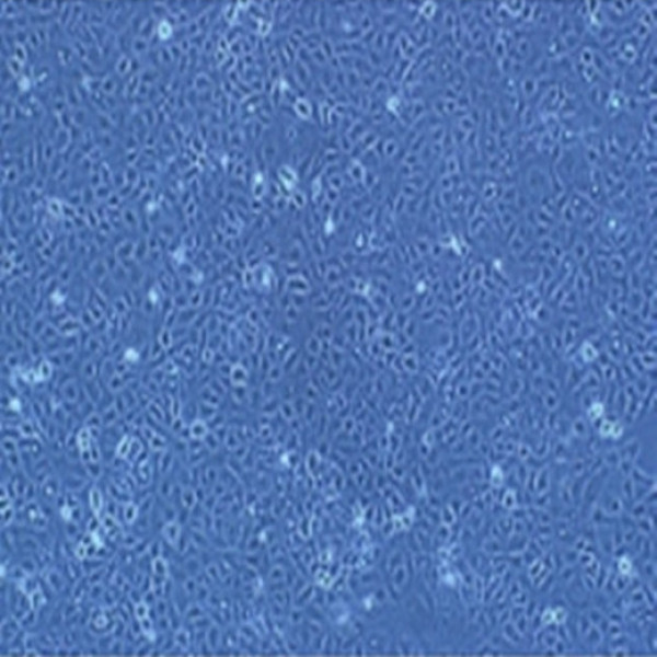 MDA-MB-415细胞