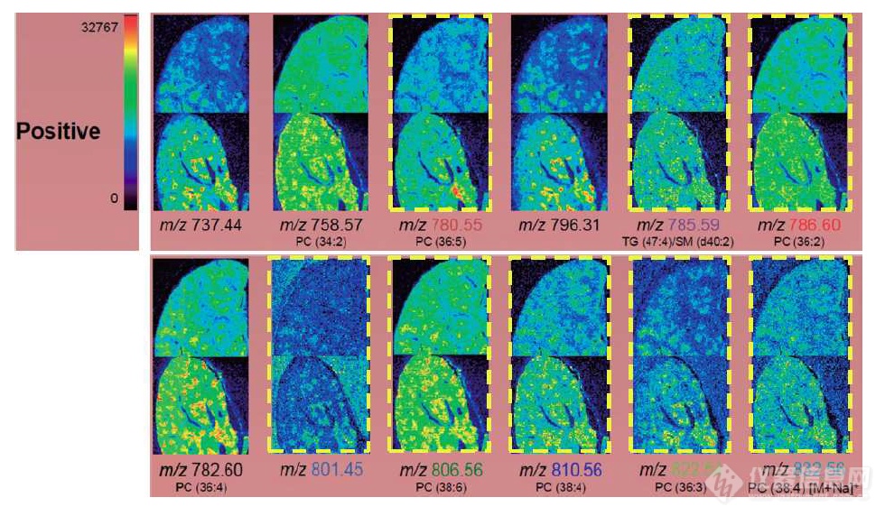 成像质谱：非酒精性脂肪肝病模型小鼠中脂类成分的可视化分析