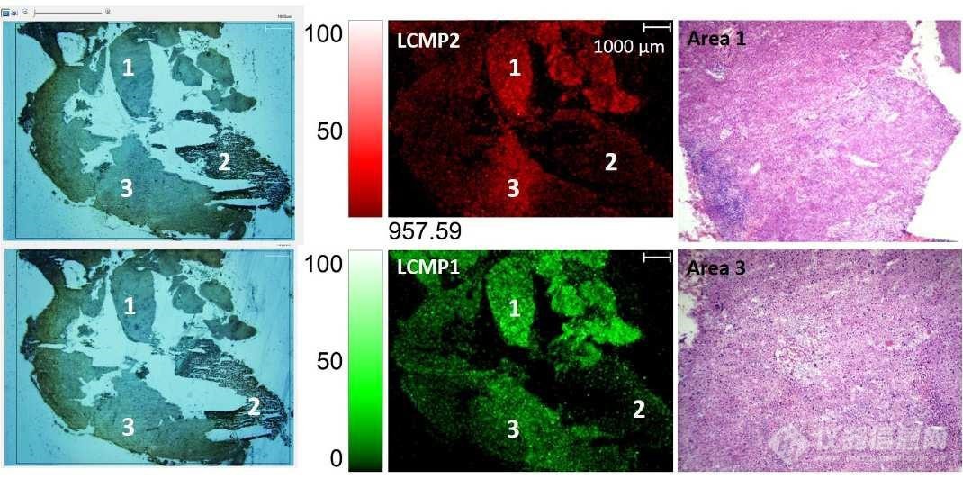 基于双功能激光可裂解探针和iMScope TRIO质谱的组织表面聚糖成像研究