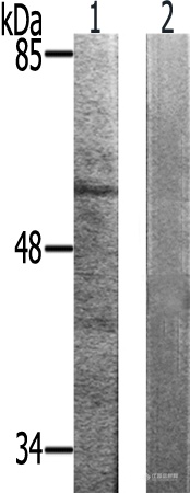 兔抗CHEK2(Phospho-Thr383) 多克隆抗体.jpg