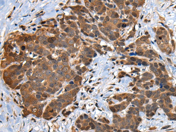 rabbit polyclonal antibody 别名:cdc28 protein kinase regulatory