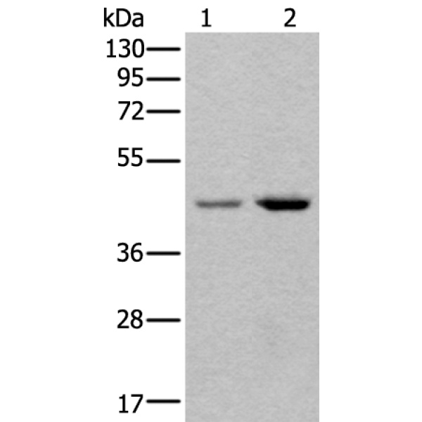 兔抗TBX1多克隆抗体