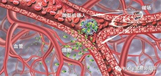 借助高精密3D打印技术释放介植入式医疗器械的创新维度