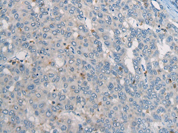 兔抗COP1多克隆抗体.jpg