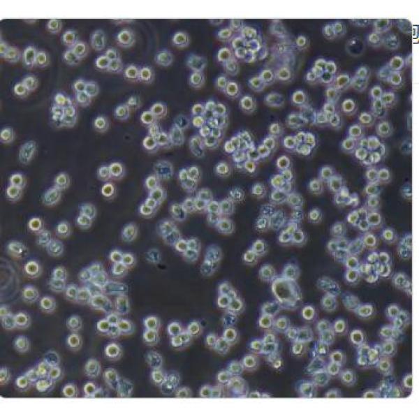 NK92 人恶性非霍奇金淋巴瘤患者的自然杀伤细胞(通过STR鉴定)