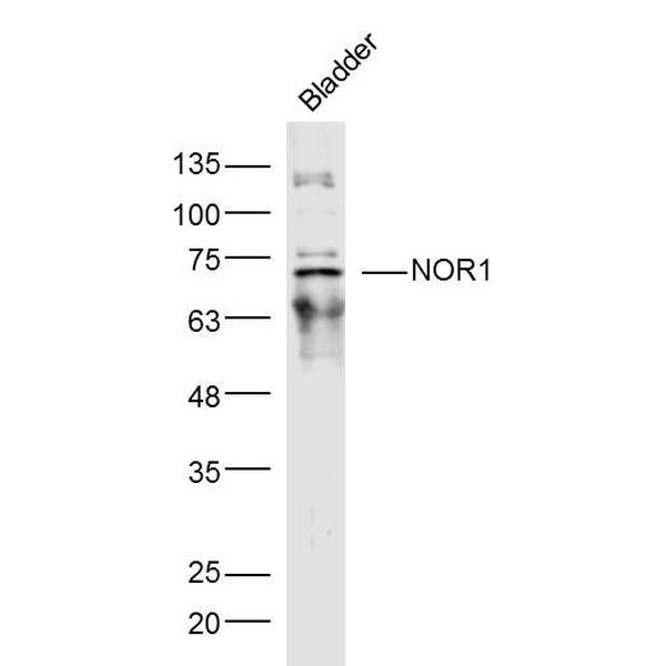 Anti-NOR1 antibody