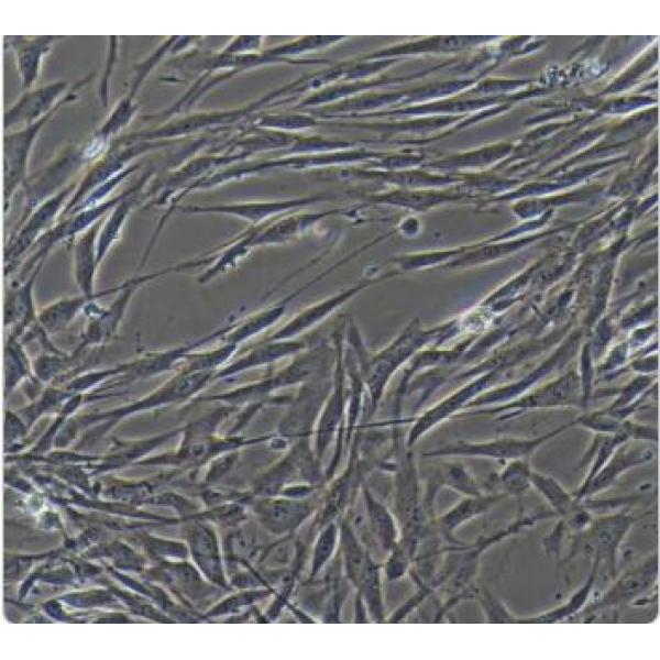 人胆囊上皮细胞永生化+GFP