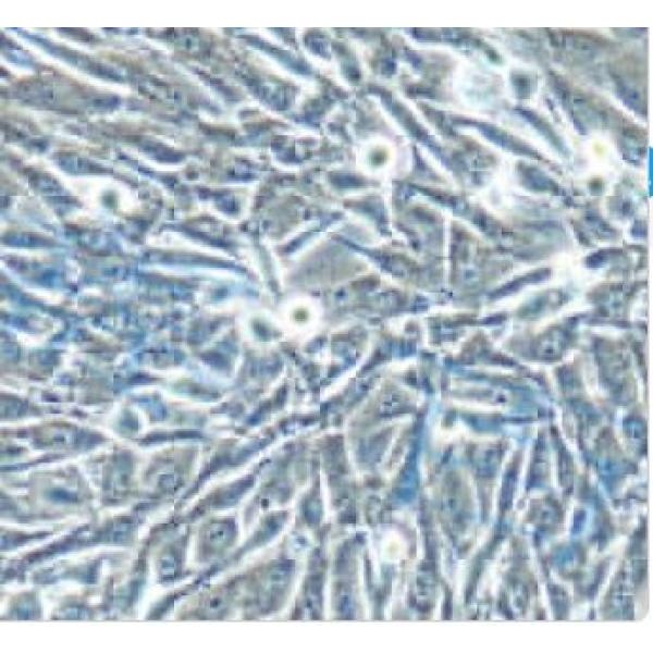 SW1353细胞（提供STR鉴定报告）